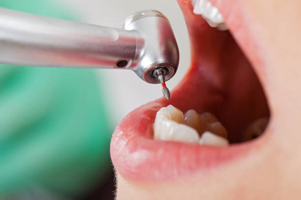 Emergency Gum Pain Relief in LA